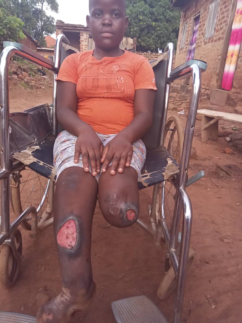 Mariam during an April 2024 St. Jude Africa care follow-up in Uganda