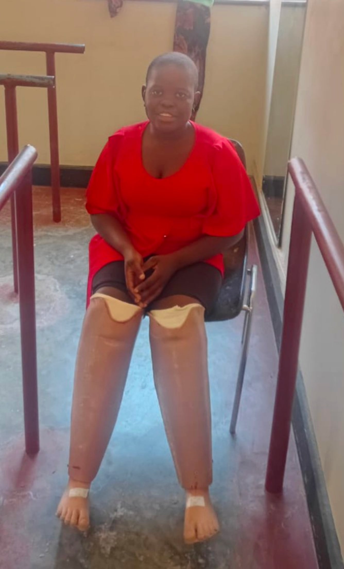 Mariam seated wearing her prosthetic legs